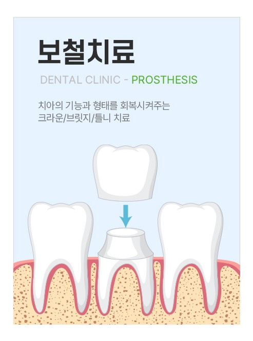 보철치료