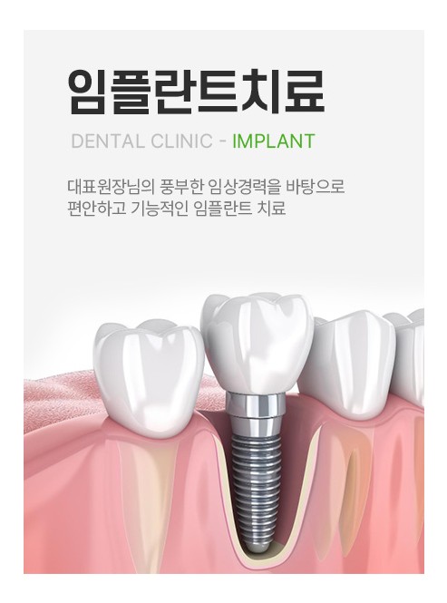 임플란트